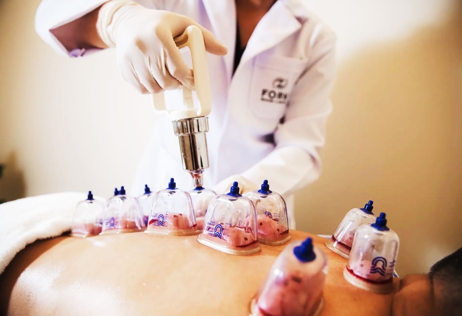 Tempat Bekam Batam Bengkel Manusia Indonesia Yayasan An Nubuwwah