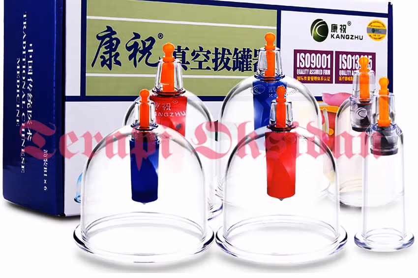Hijama, A Forgotten Source of Barakah