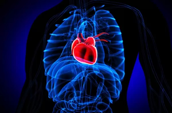 Bekam sembuhkan penyakit darah tinggi (hipertensi)