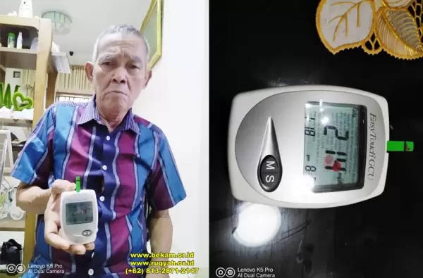 Anomali darah bekam pasien di Bengkel Manusia Indonesia